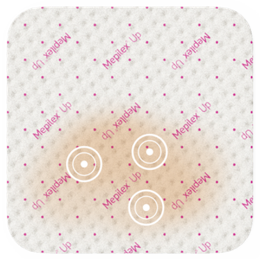 An illustration showing how wound fluid spreads under a Mepilex Up wound dressing. 