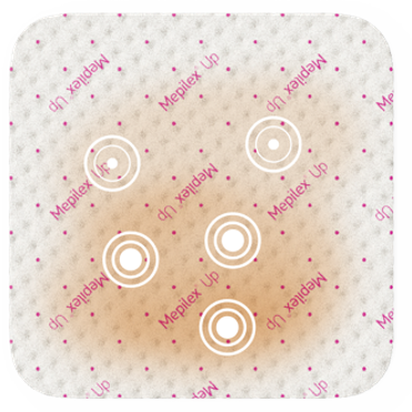 An illustration showing how the fluid continues to spread under a Mepilex Up wound dressing. 