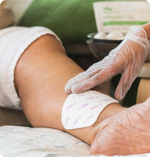 Healthcare professional applying Mepilex Up to leg ulcer
