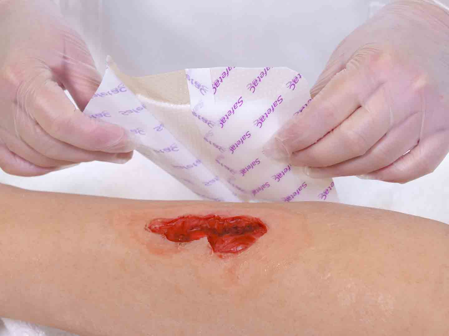 Fjern beskyttelsespapir før applisering på sår